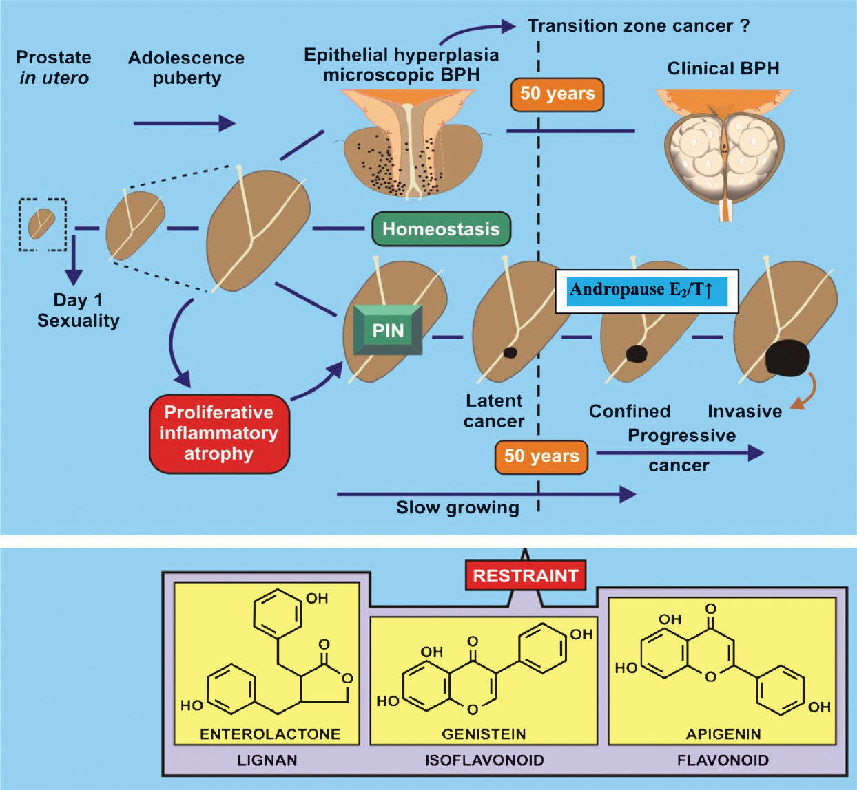 Hypothetical model of stages in the development of benign prostatic hyperplasia (BPH) and cancer. The influence of phytoestrogens on sexual dimorphism, and later in life, the increasing oestrogen status in the male may be redressed by phytoestrogens at mid-life and hence reduces the incidence of clinical BPH and cancer. Prostatic intraepithelial neoplasia (PIN), a possible premalignant lesion may lead to cancer unless restrained by phytoestrogens. E2/T ↑ refers to the relative rise in oestradiol/testosterone ratio of the ageing male.